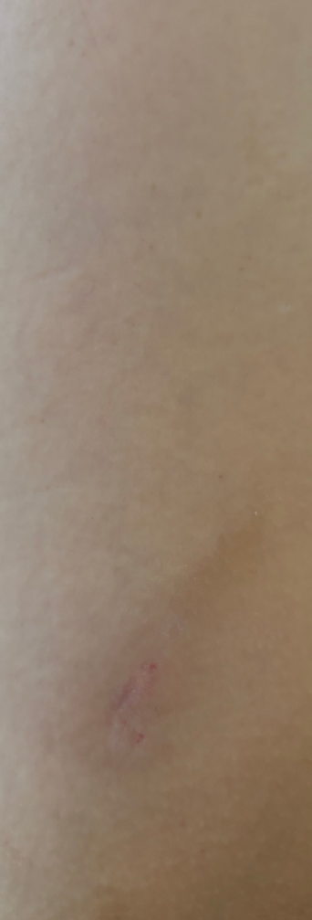 After — Skin Shield