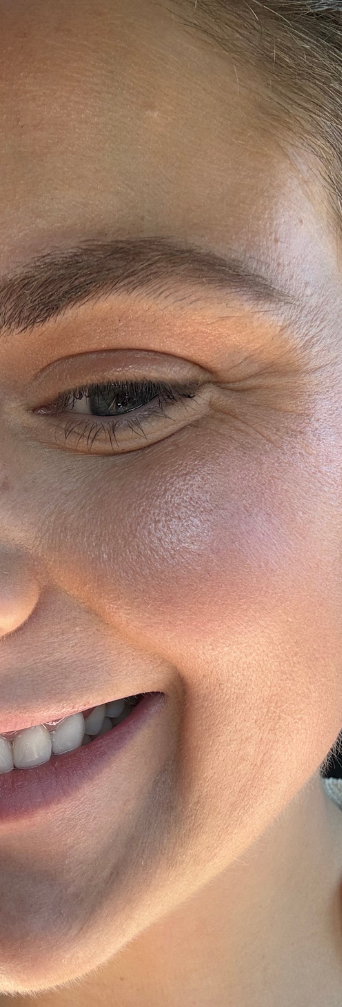 After — Babe Blotter
